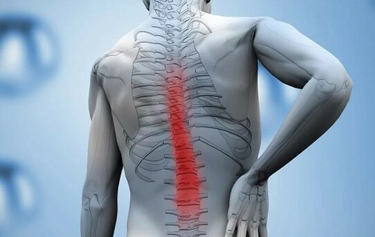 Dolor de espalda en la región lumbar debido a espondilitis anquilosante